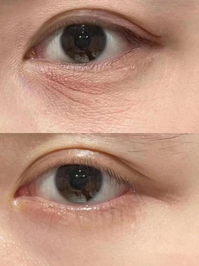 牌子好？年度抗老眼霜决赛圈熬夜总结OG真人25岁男士眼霜去眼袋哪个