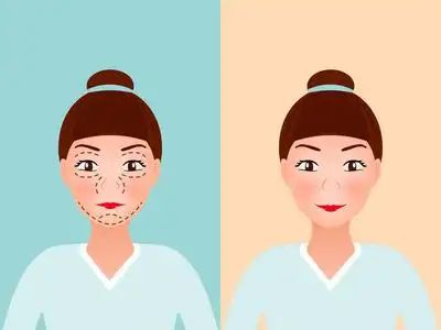 项目比较好？几天见效术后案例医院OG真人平台想要眼部提升做什么