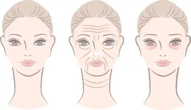 项目比较好？几天见效术后案例医院OG真人平台想要眼部提升做什么(图2)
