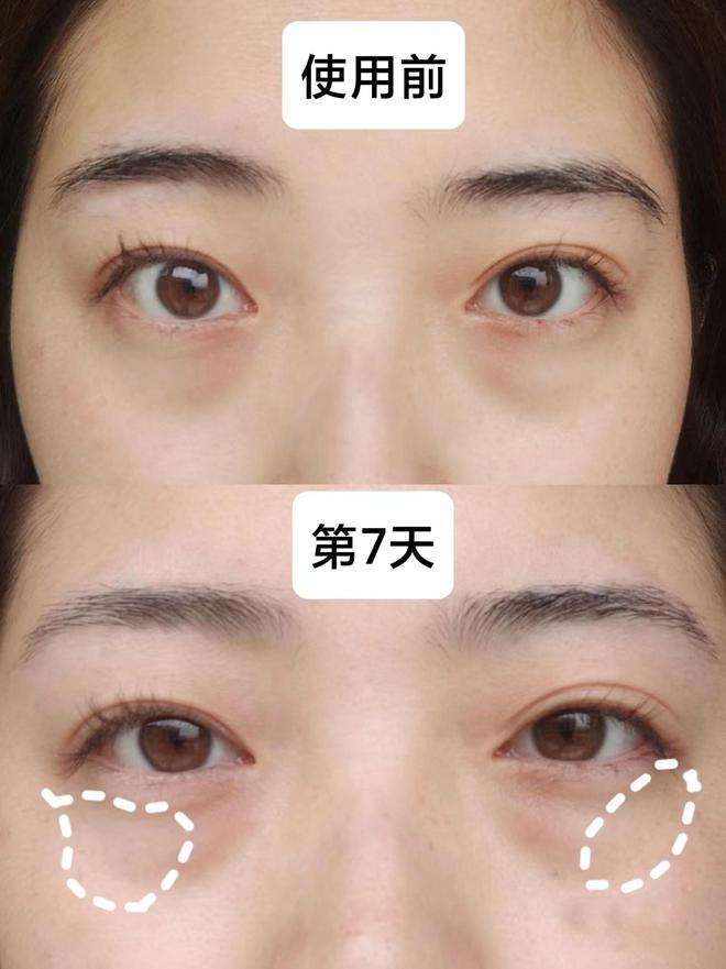个牌子好？实话实说拒绝当韭菜的眼霜OG真人平台25岁男士眼霜去眼袋哪
