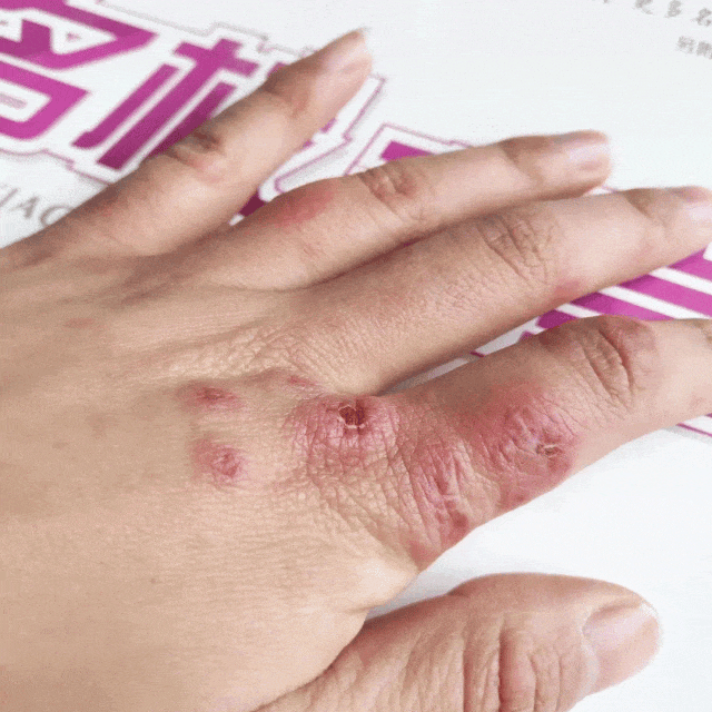 试这个外抹的方子一试就灵OG网站手足干裂的人试(图11)