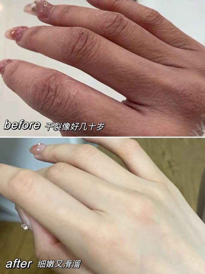 试这个外抹的方子一试就灵OG网站手足干裂的人试(图19)