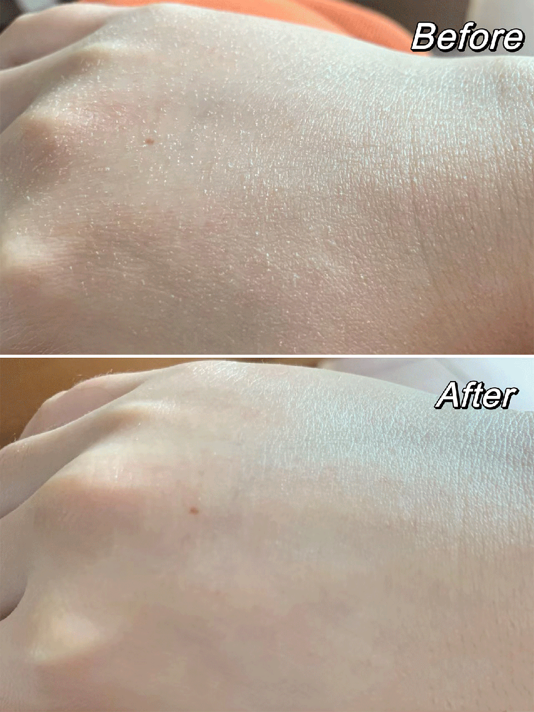 试这个外抹的方子一试就灵OG网站手足干裂的人试(图20)